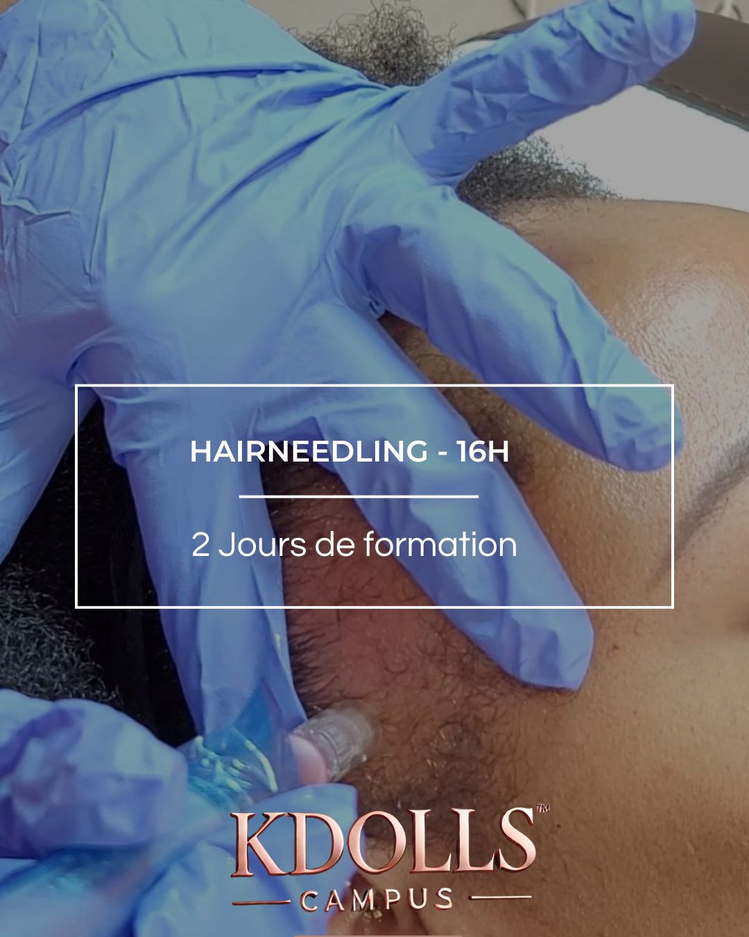 Hairneedling Kdolls Campus